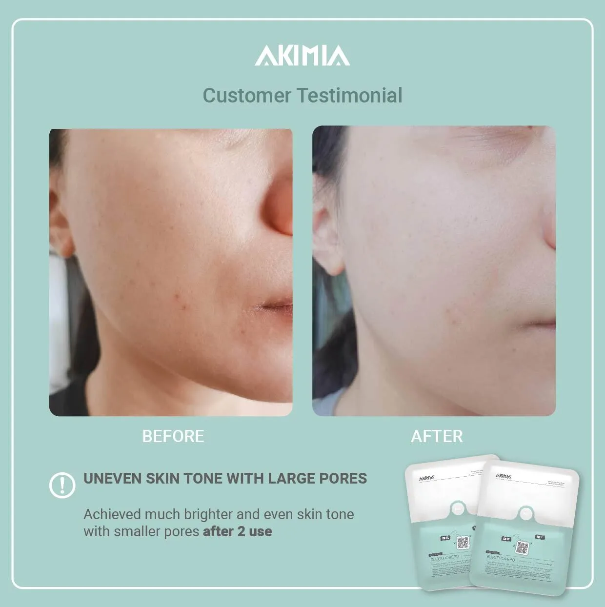 Akimia before and after_R1-29