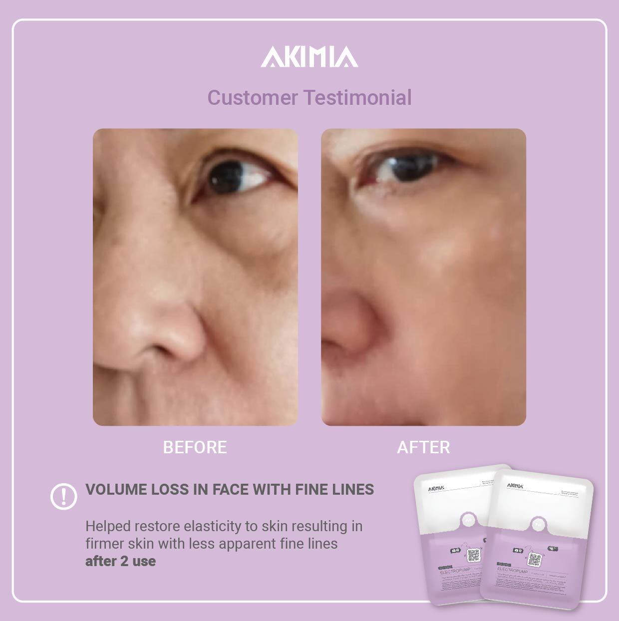 Akimia before and after_R1-18