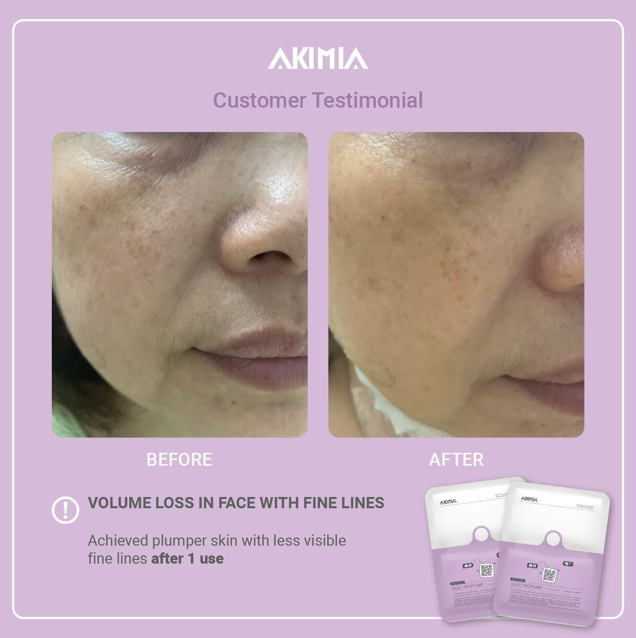 Akimia before and after_R1-20