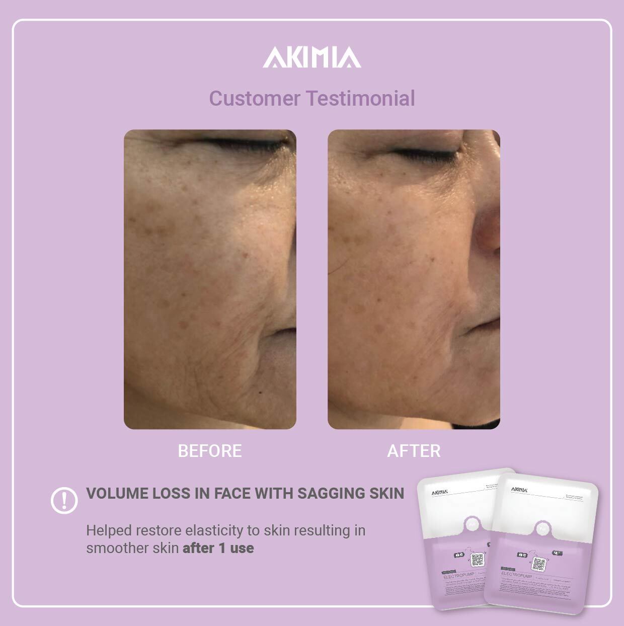 Akimia before and after_R1-22