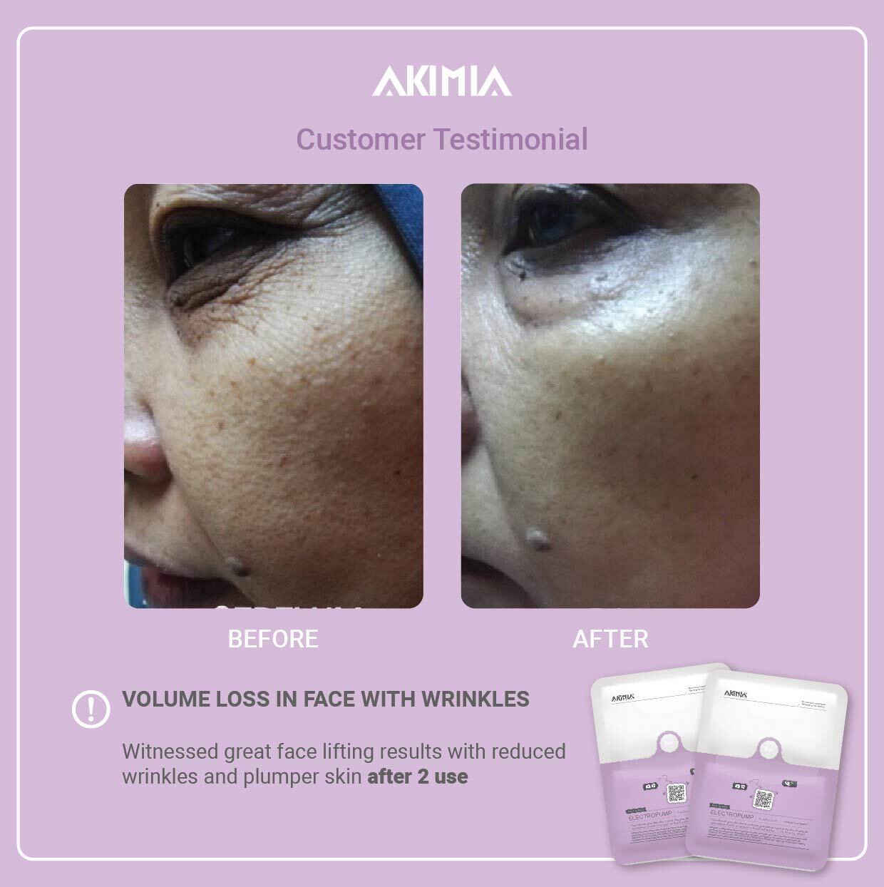 Akimia before and after_R1-19