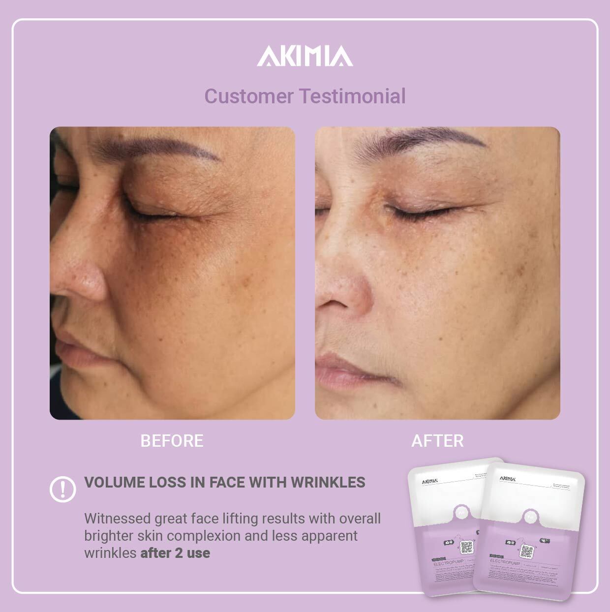 Akimia before and after_R1-21