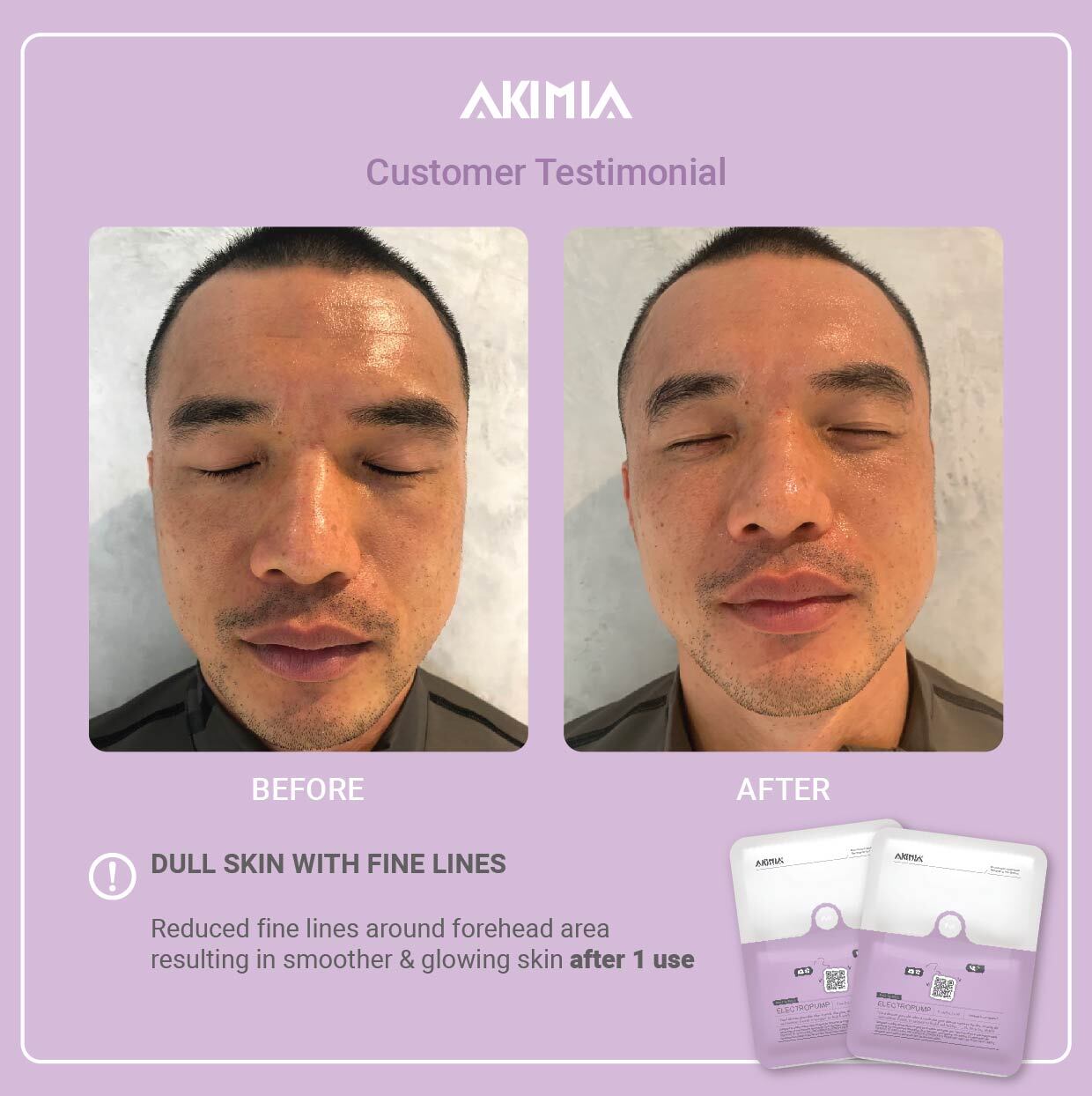 Akimia before and after_R1-23