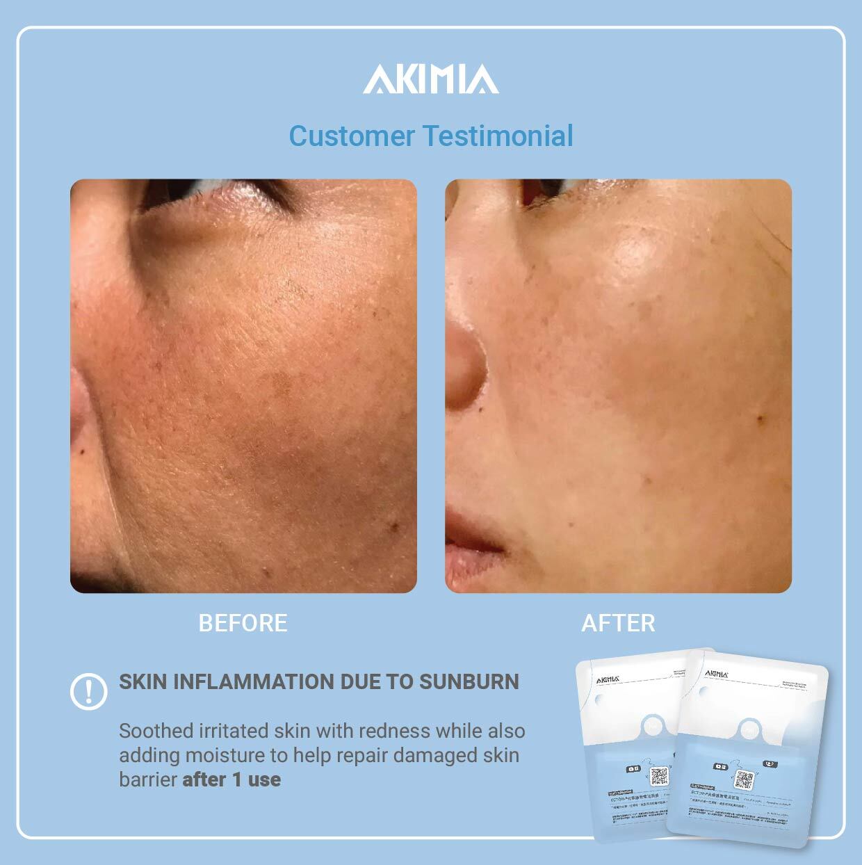 Akimia before and after - Repair-12