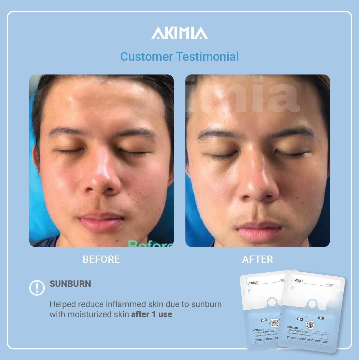 Akimia before and after - Repair-16