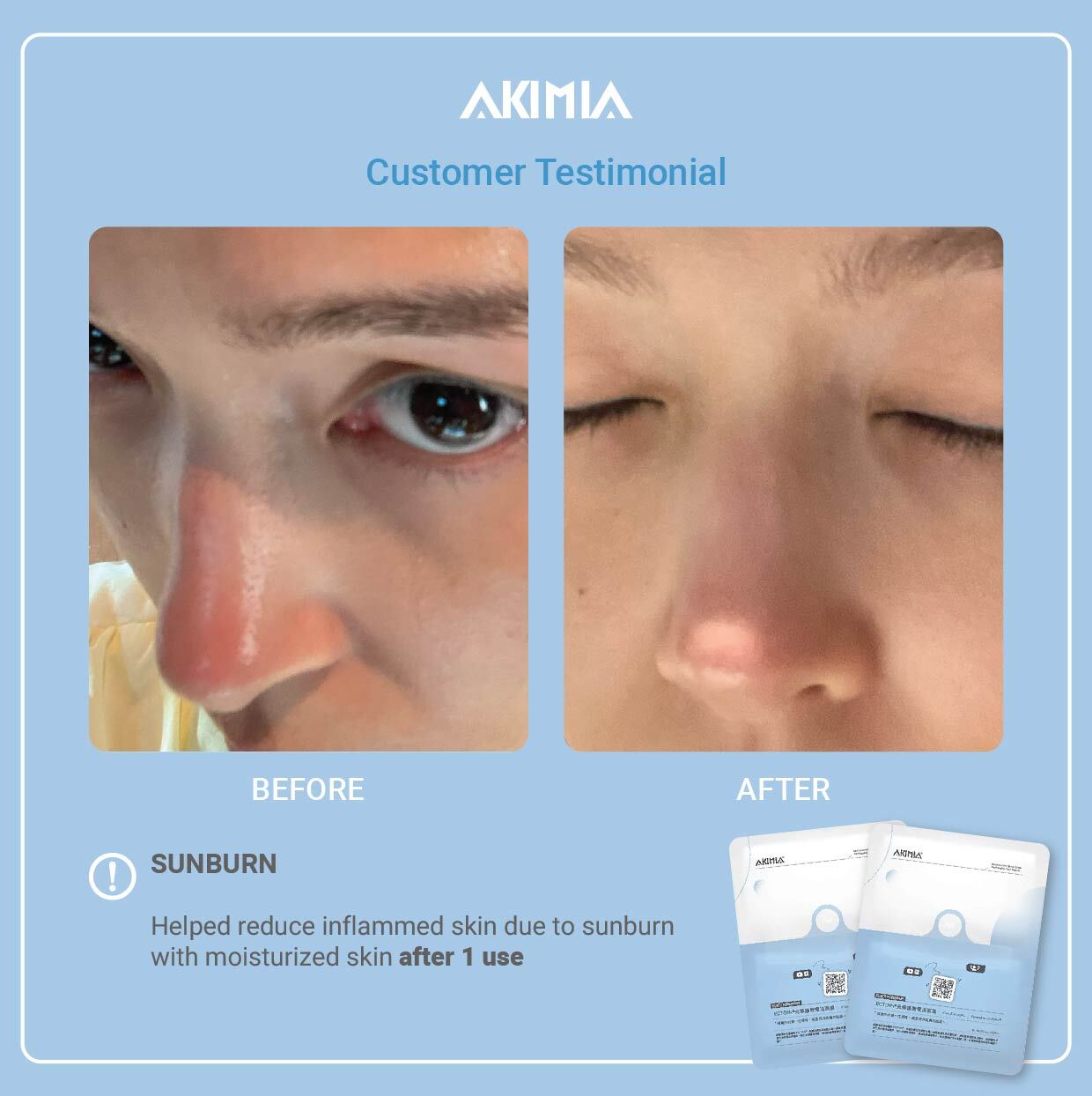 Akimia before and after - Repair-17