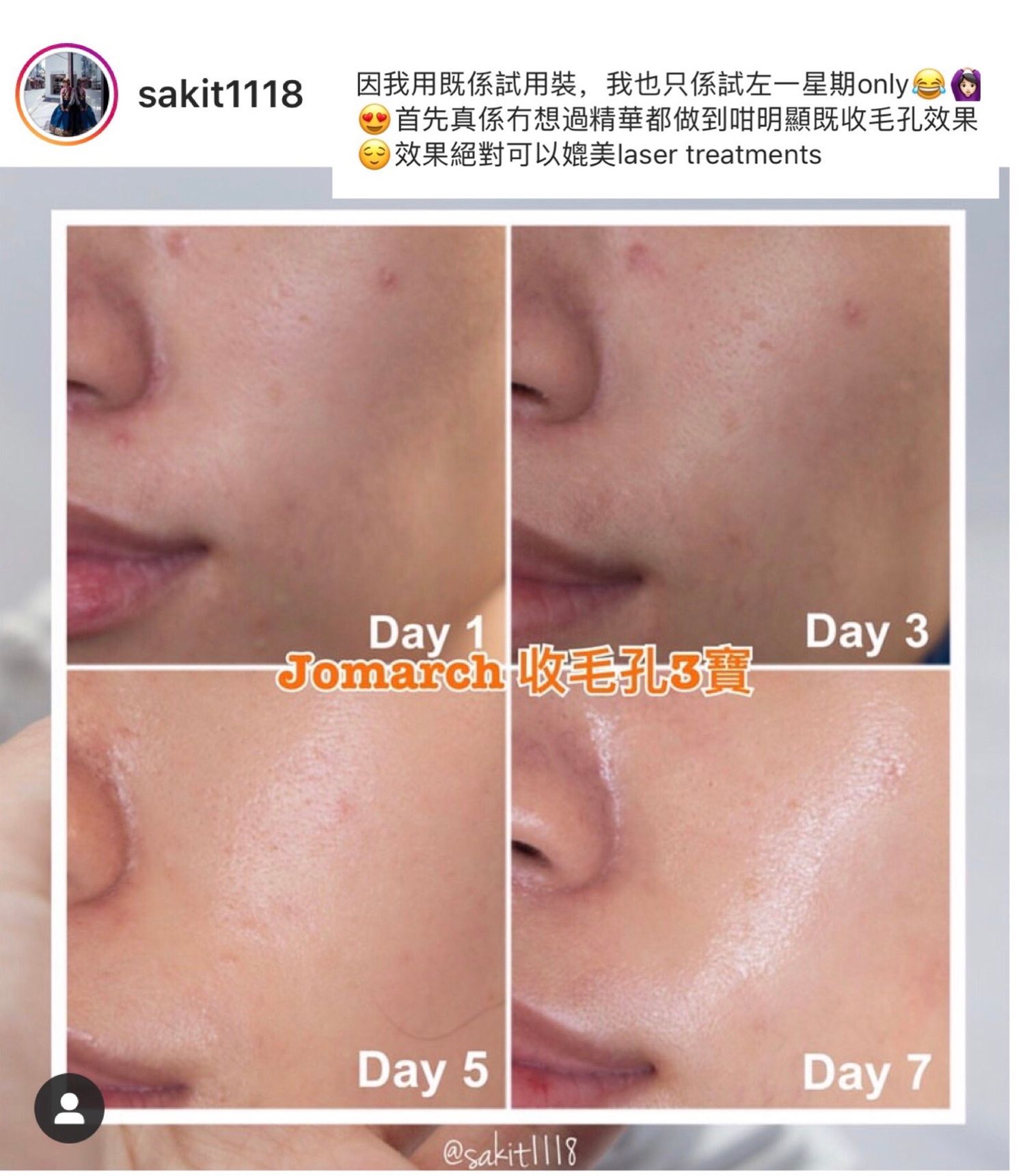 jomarchbeauty - sakit1118 (Hong Kong Beauty Blogger)