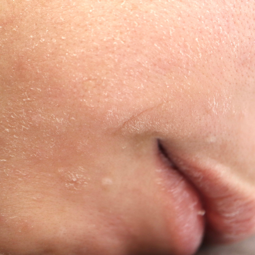 Rough Texture Solution