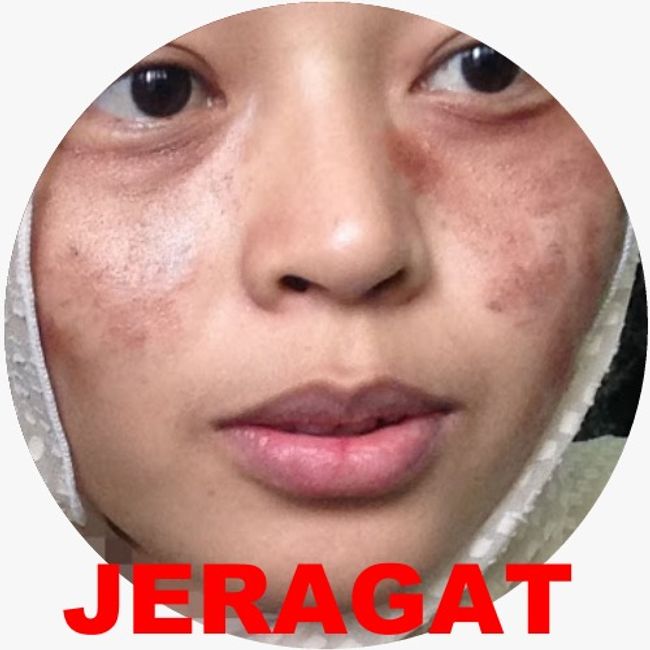 neuadvanceserumskincare | ANDA ADA MASALAH MACAM NI ??? - 