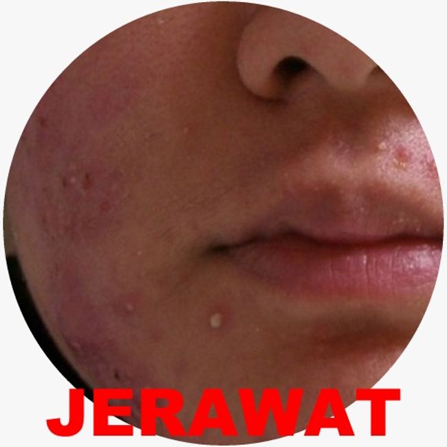 neuadvanceserumskincare | ANDA ADA MASALAH MACAM NI ??? - 