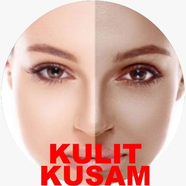 neuadvanceserumskincare | ANDA ADA MASALAH MACAM NI ??? - 