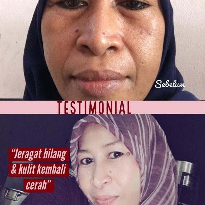 effect neu serum.jpg