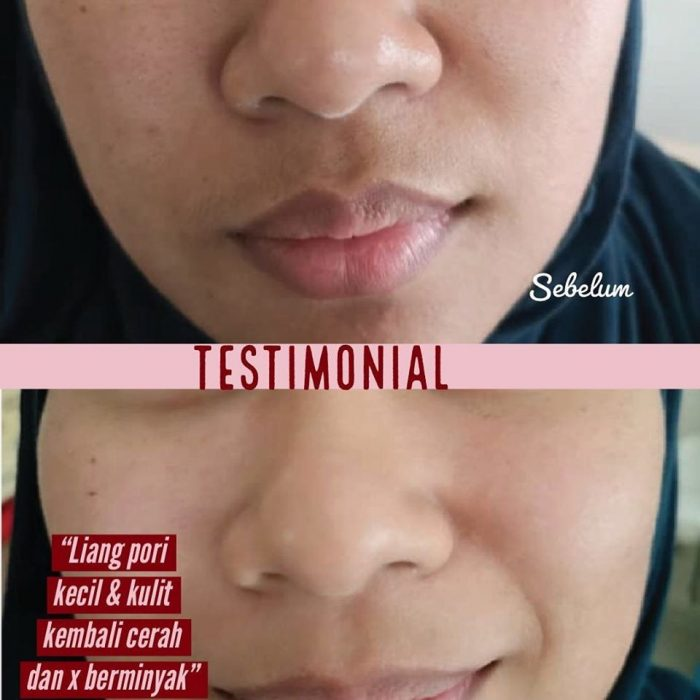 hilangkan jeragat neu serum.jpg