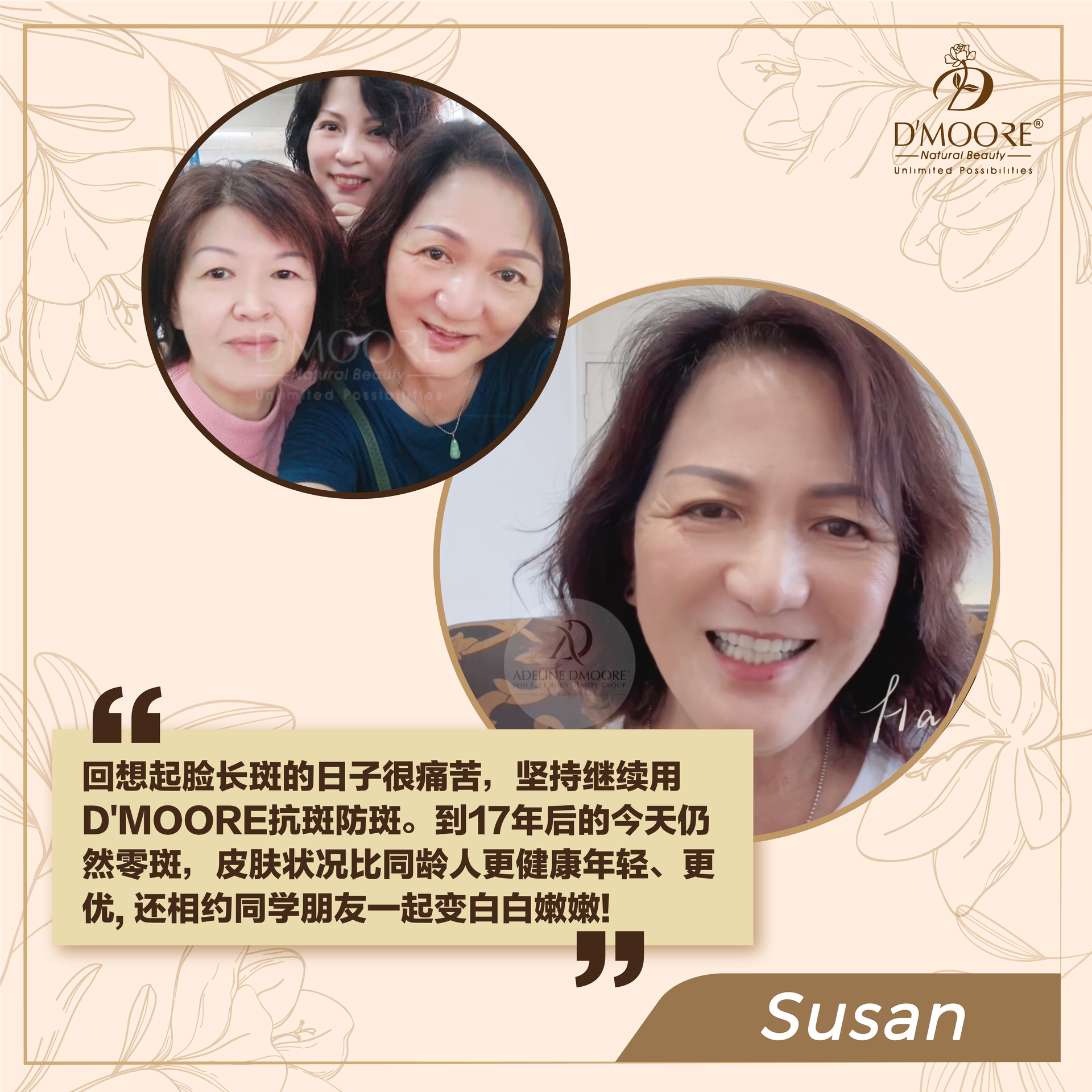 D'MOORE Official Site | The Spotless Skin of Confidence - SUSAN (Selangor)