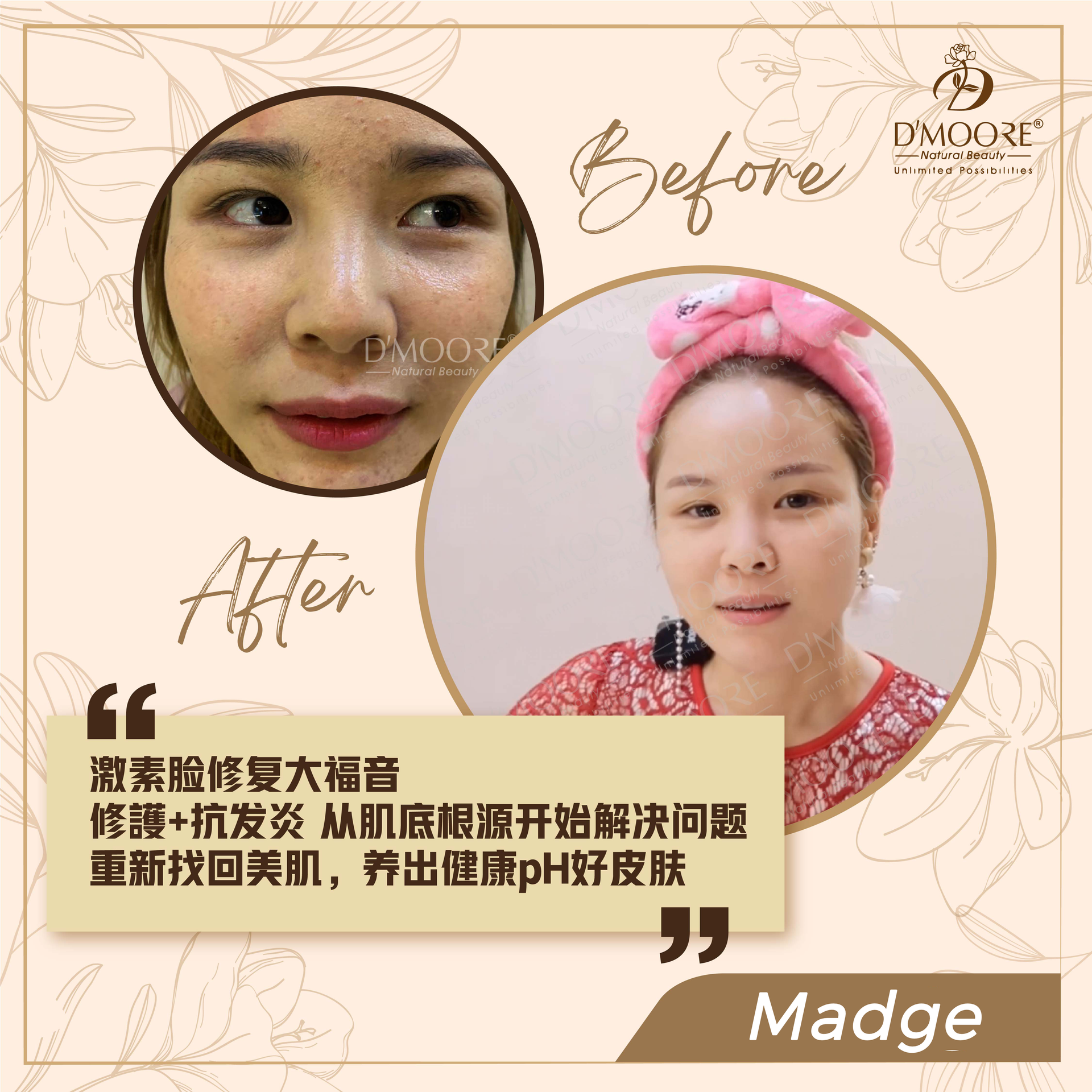 D'MOORE Official Site | The Spotless Skin of Confidence - MADGE (Sarawak)