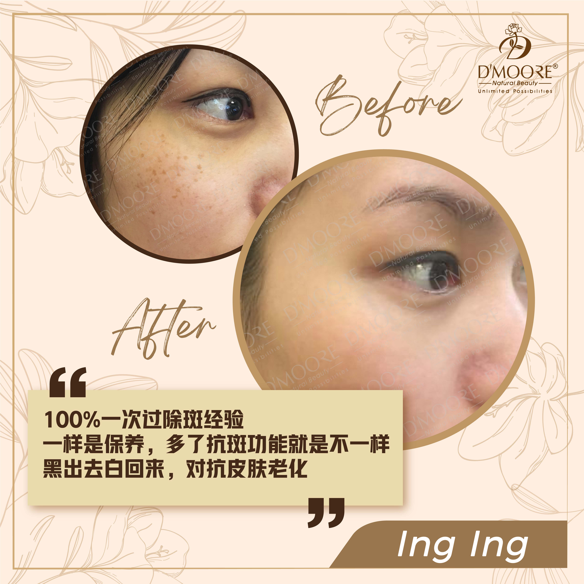 D'MOORE Official Site | The Spotless Skin of Confidence - ING ING (Sarawak)