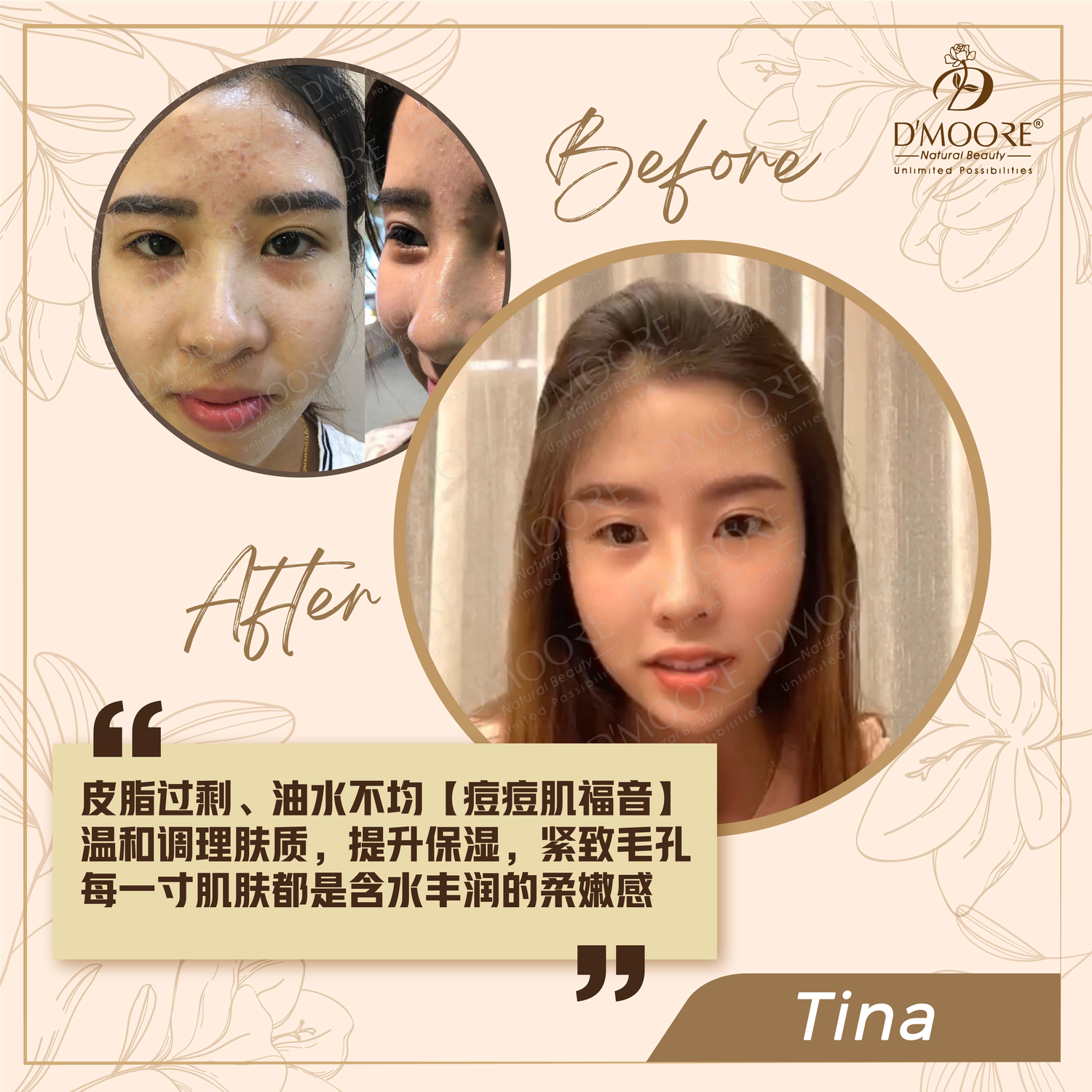 D'MOORE Official Site | The Spotless Skin of Confidence - TINA (Sarawak)