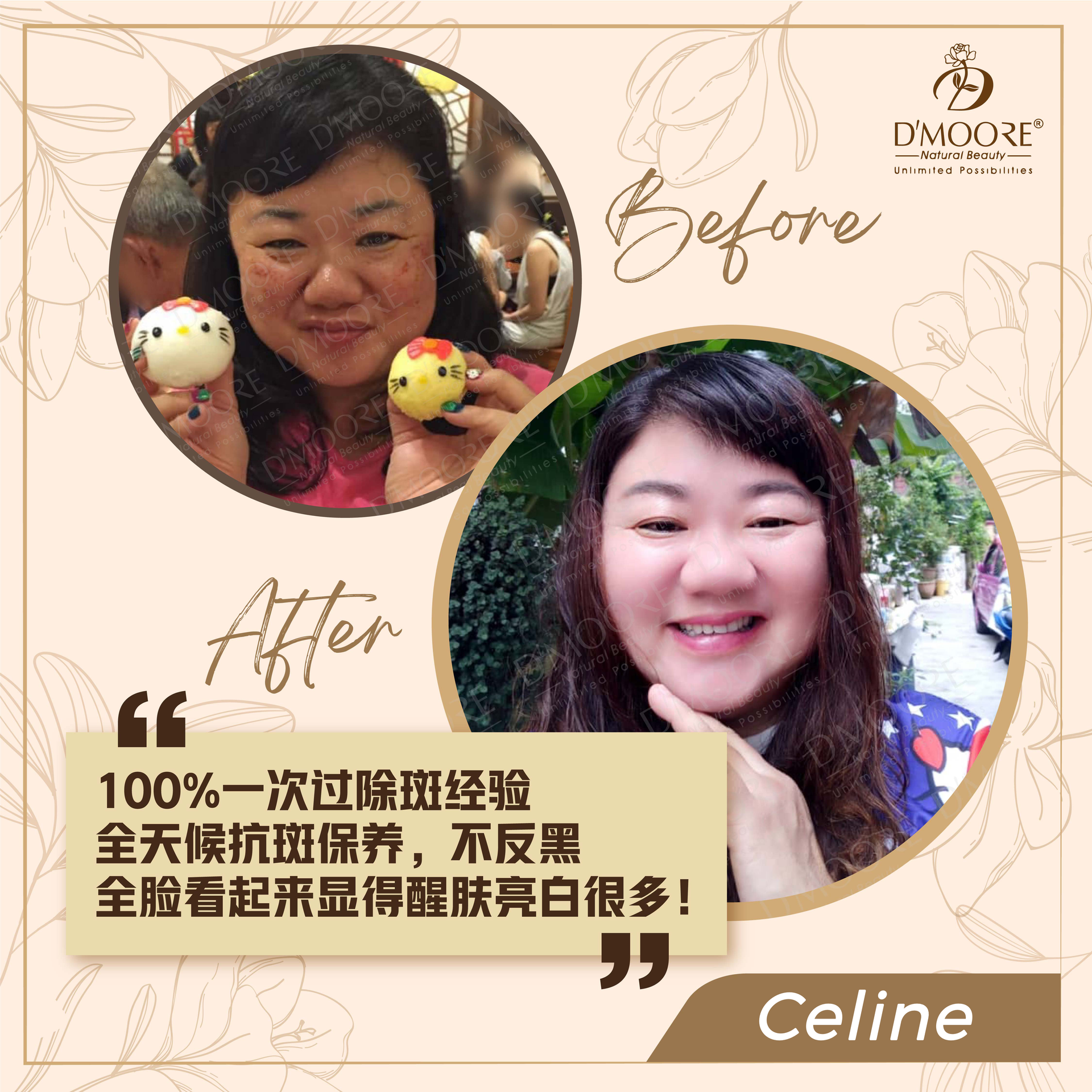 D'MOORE Official Site | The Spotless Skin of Confidence - CELINE (Johor)