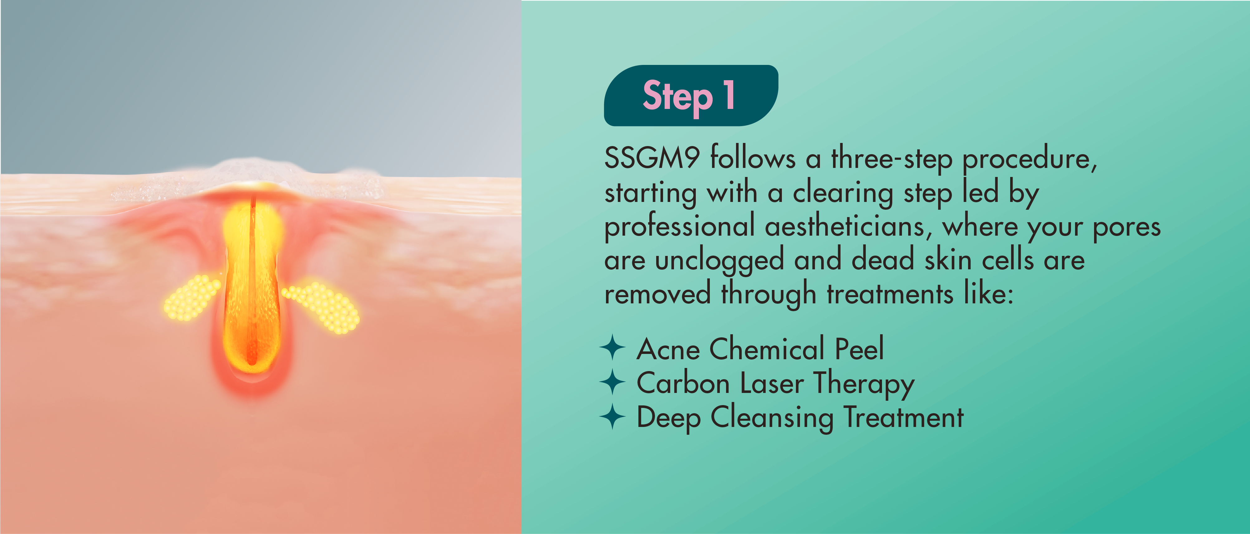 SSGM9 follows a three-step procedure, starting with a clearing step led by professional aestheticians, where your pores are unclogged and dead skin cells are removed through treatments like: Acne Chemical Peel Carbon Laser Therapy Deep Cleansing Treatment