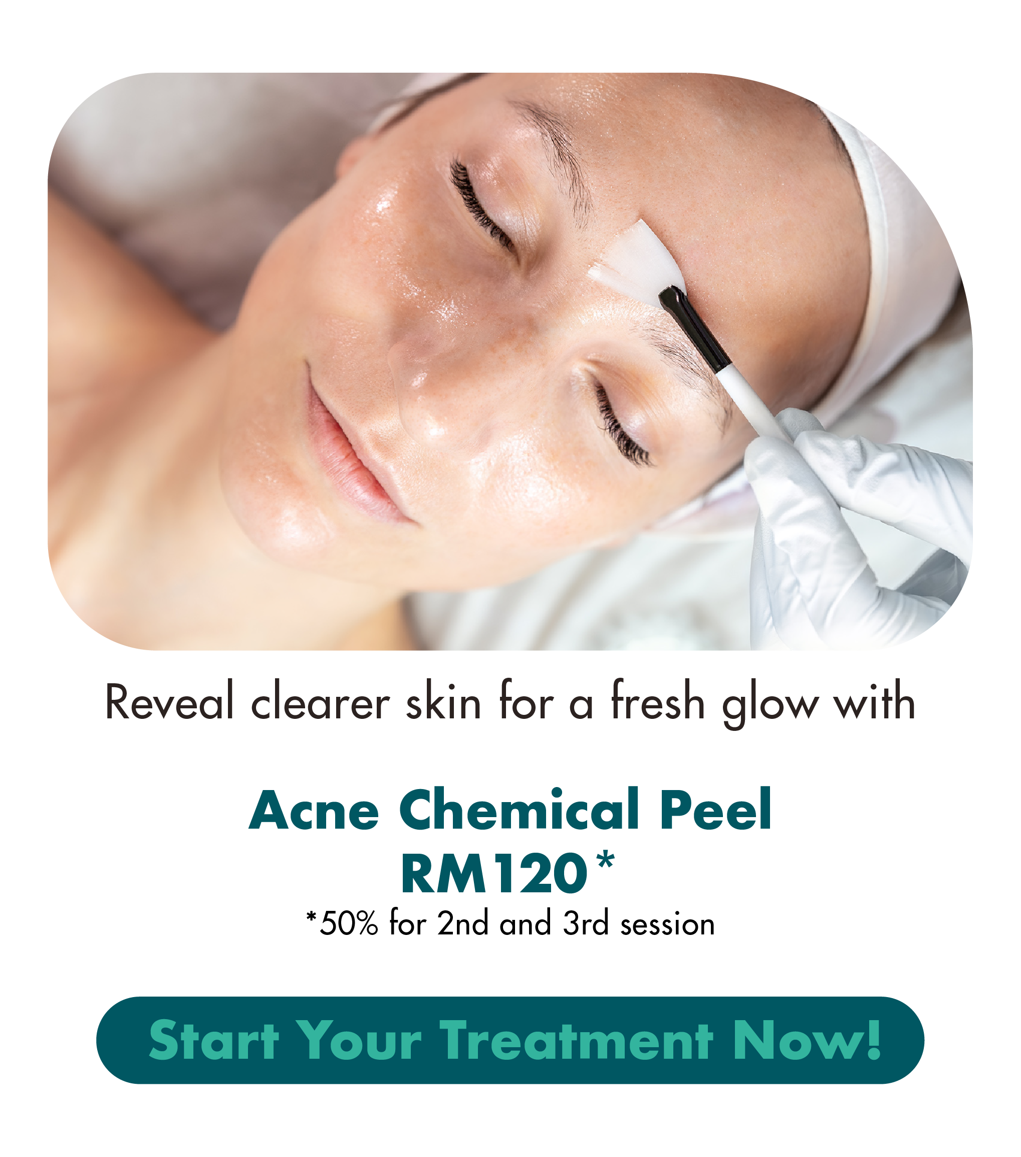 Reveal clearer skin for a fresh glow with Acne Chemical Peel RM120 Start Your Treatment Now!