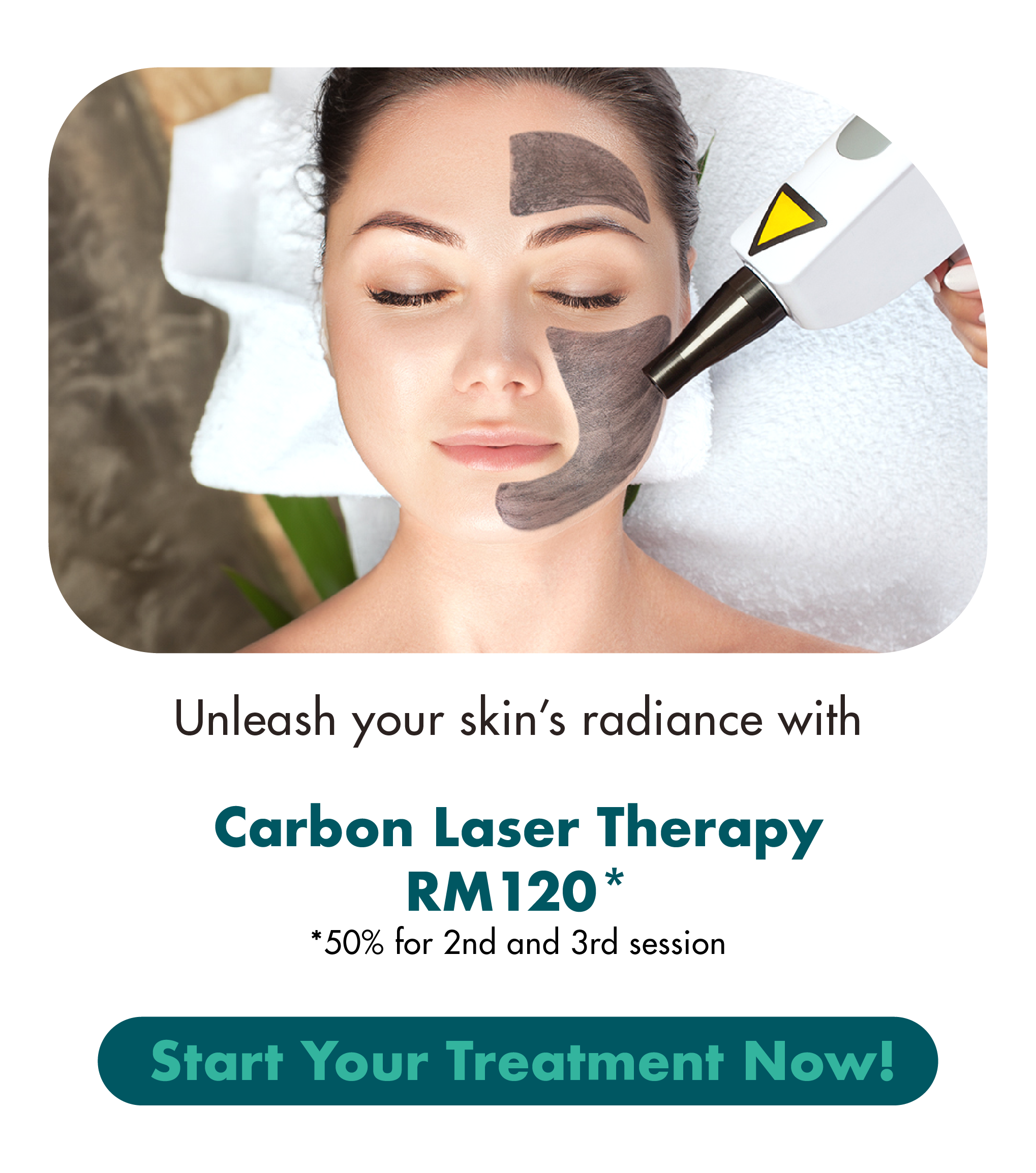 Unleash your skin's radiance with Carbon Laser Therapy RM120* Start Your Treatment Now!