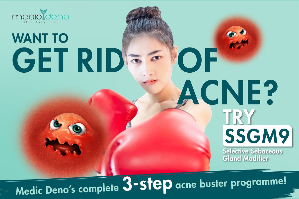 Get rid of Acne with SSGM9