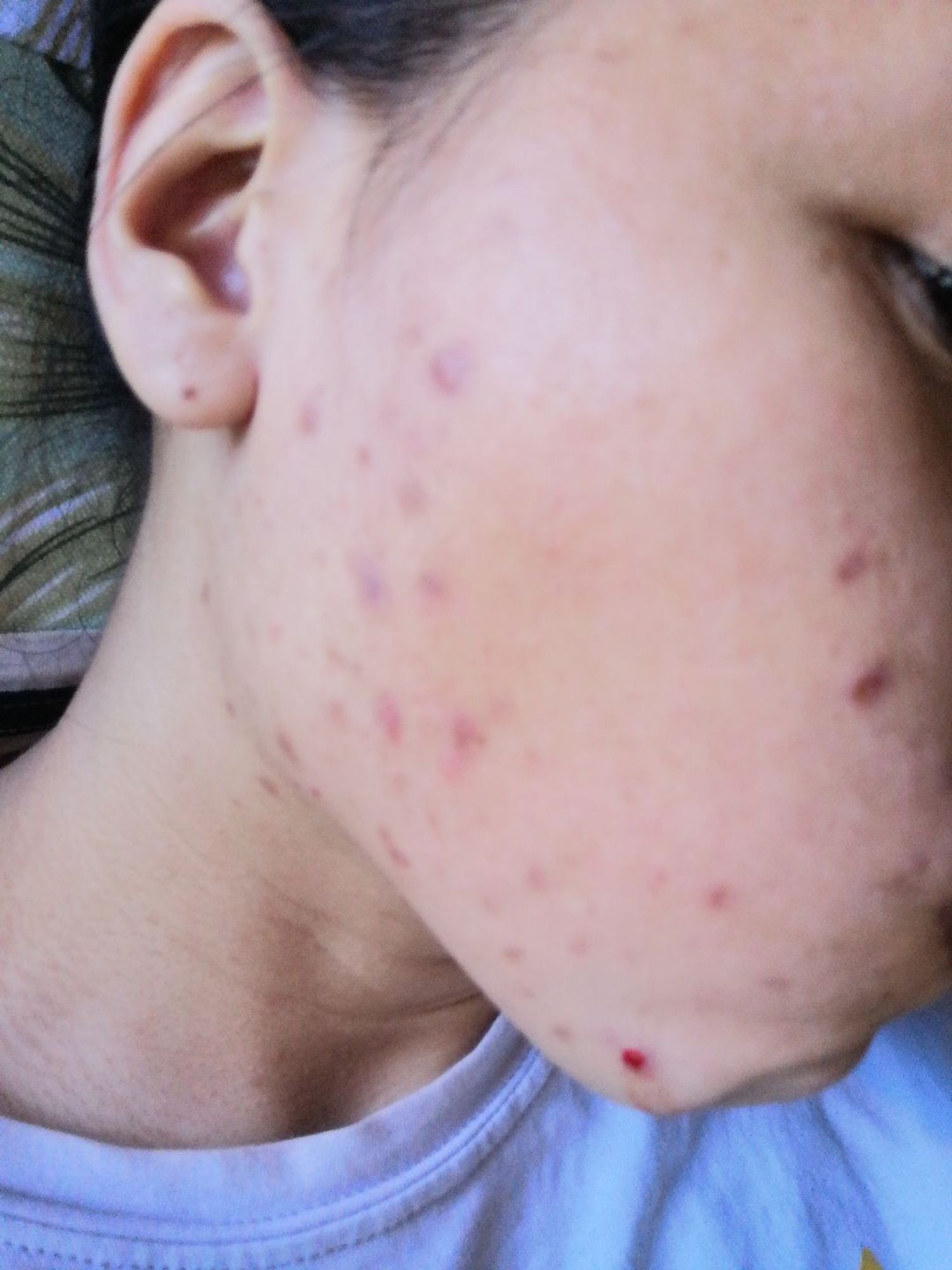 Teamonkl_bysue - Amira Adila