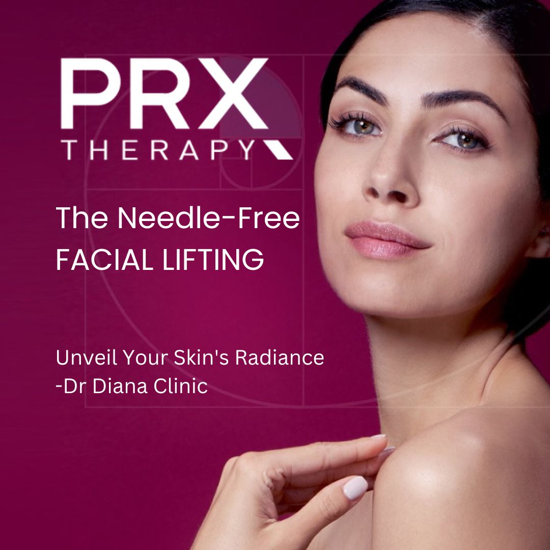 prx t33 peel