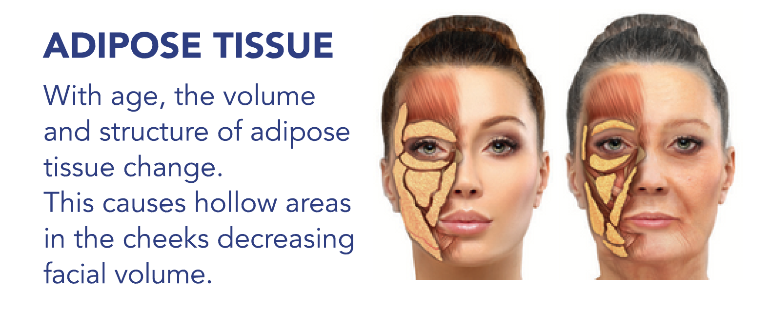 Structura Adipoe Tissue klinik dr diana