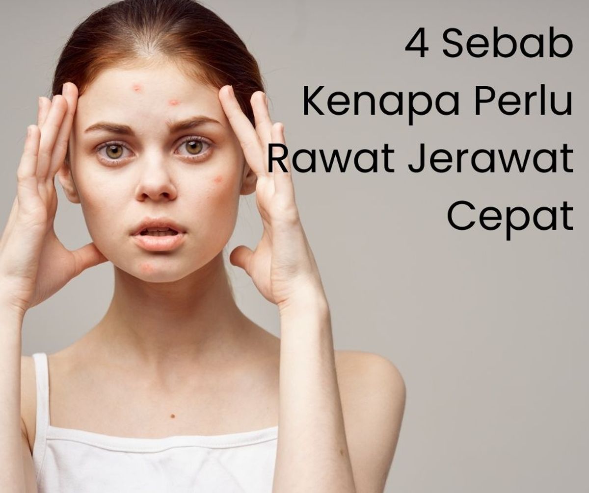 4 Sebab Kenapa Perlu Rawat Jerawat Dengan Cepat.