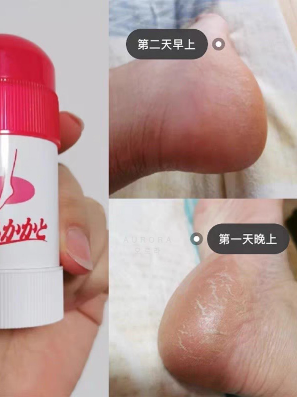 BFBA8CCF-BCCA-4F74-BFB4-36E2DFDB34E1