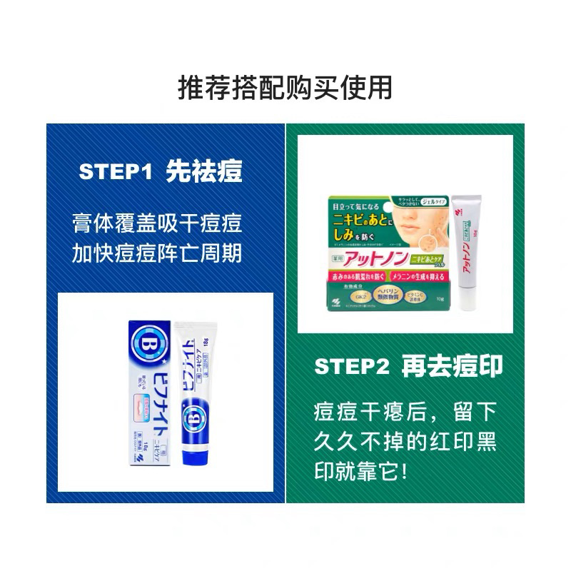 DFC5CF47-BB8A-43BA-916E-77A3960C3D78