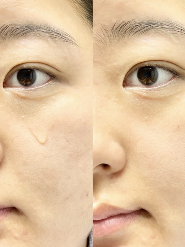 7367622a718da721933d748fa146856b