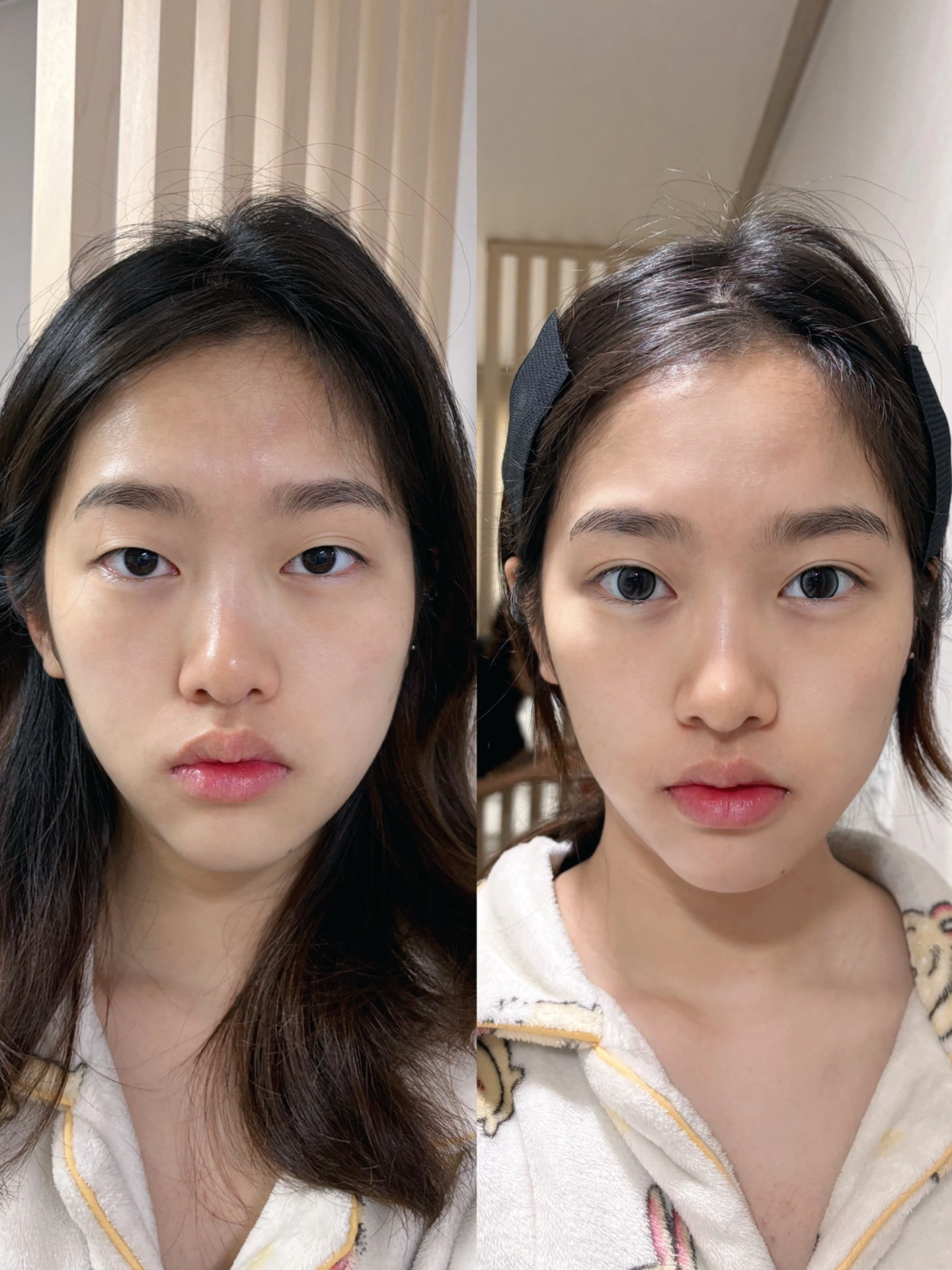 ac5aba2f84169159d1fb8d1b58d0f3a6