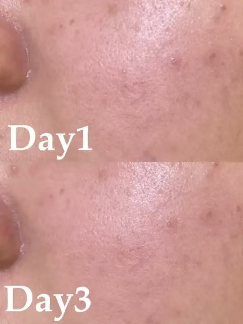 78a70fc11a1ad904e9bfe0dcbeda7c23