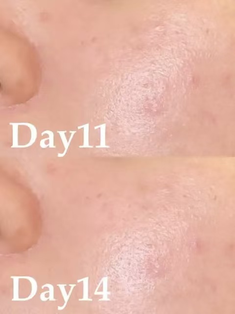 285acd495e25ffea7737299a0196c2d6