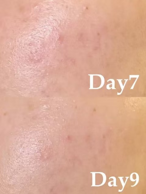 5ff0887d52a816f7b19113bed73f8703