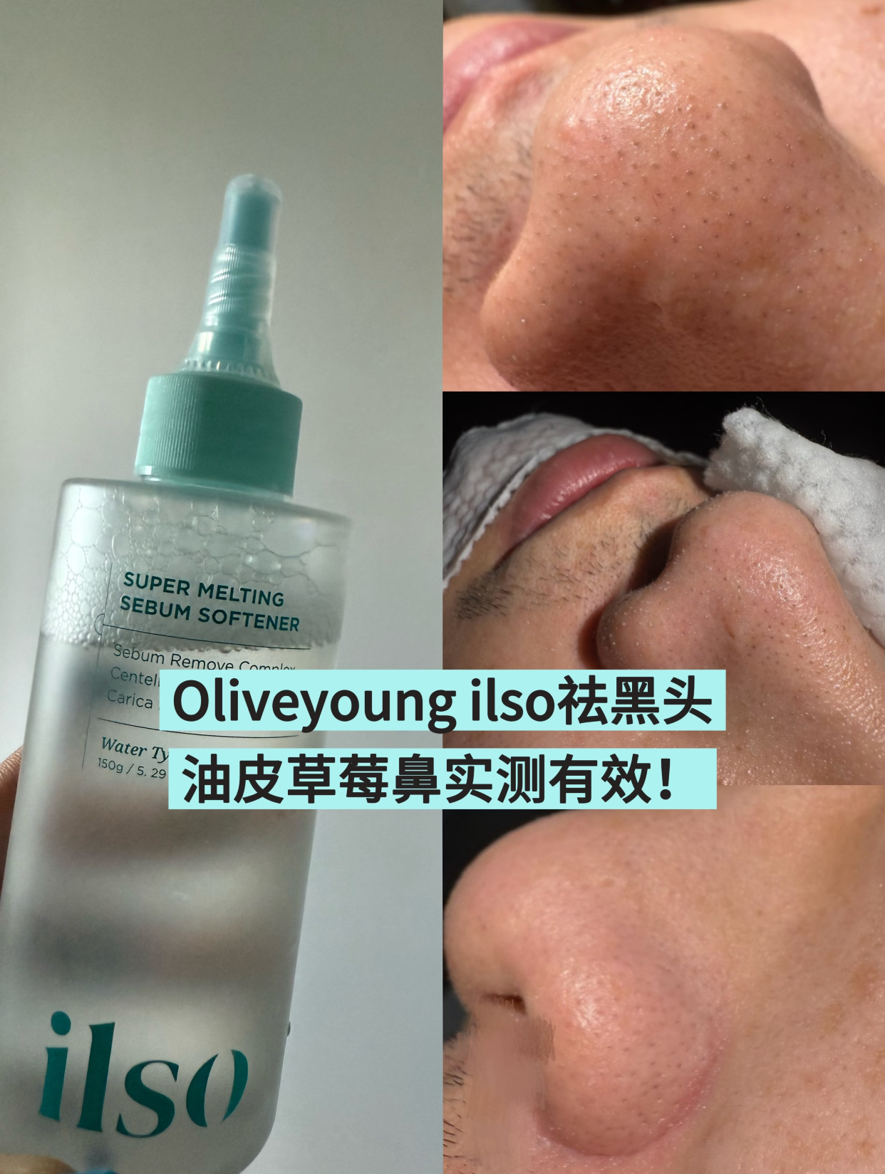 9389dd1d090bcbc00ad9b1f77f337528