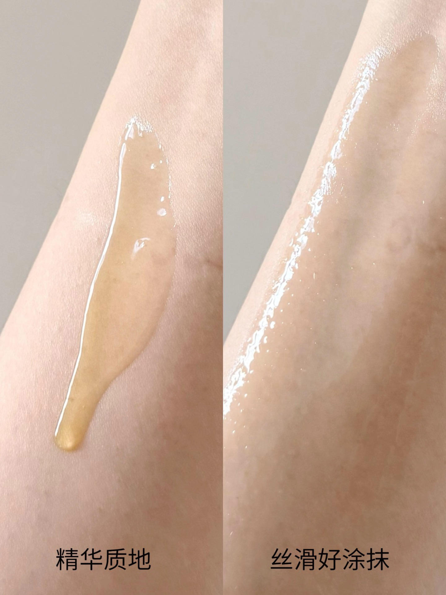 db76ee48b904f42100dfda2a8b5d9deb