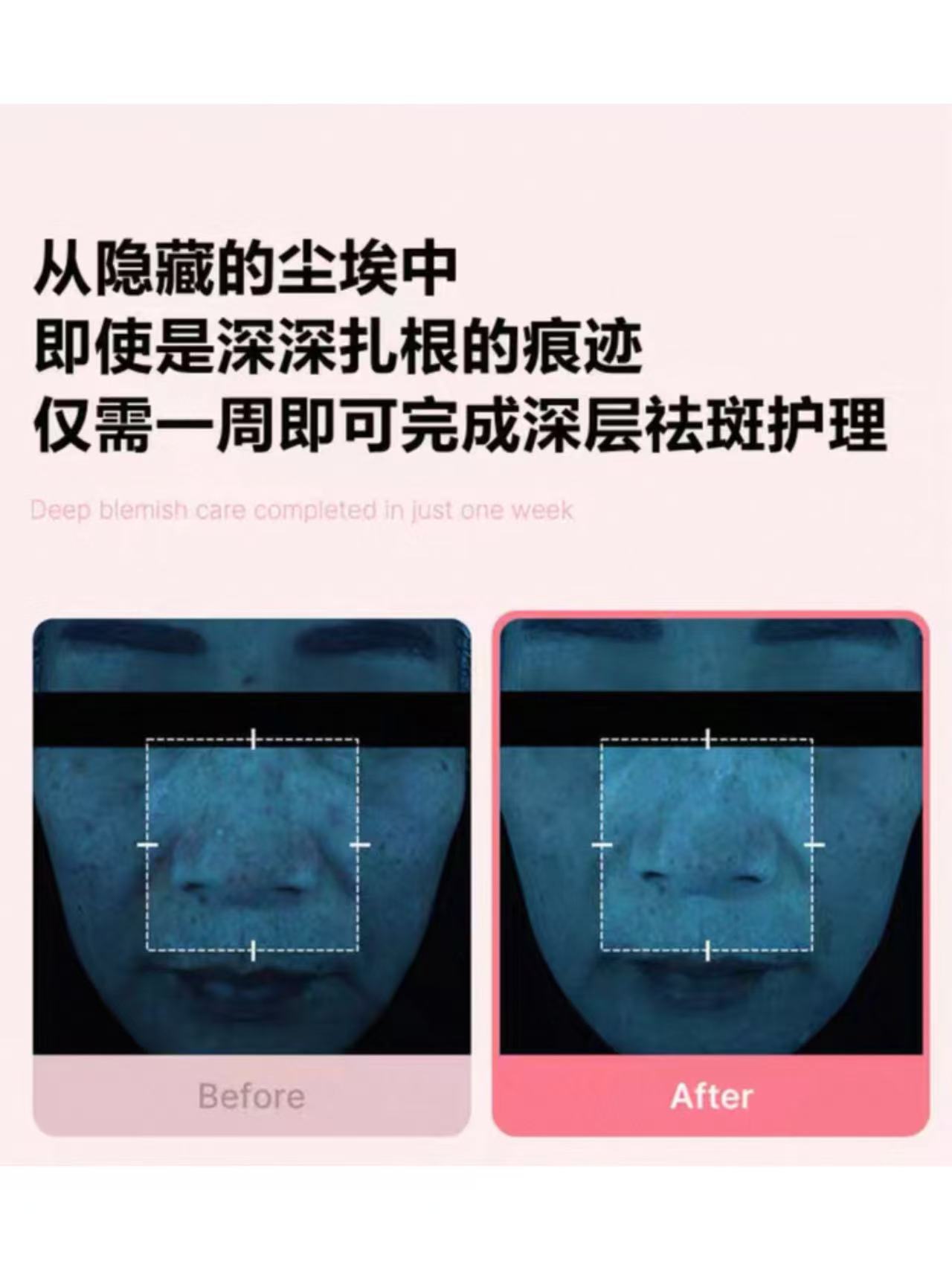 e24bff9aa039fcb751a4ce91a871ccf7