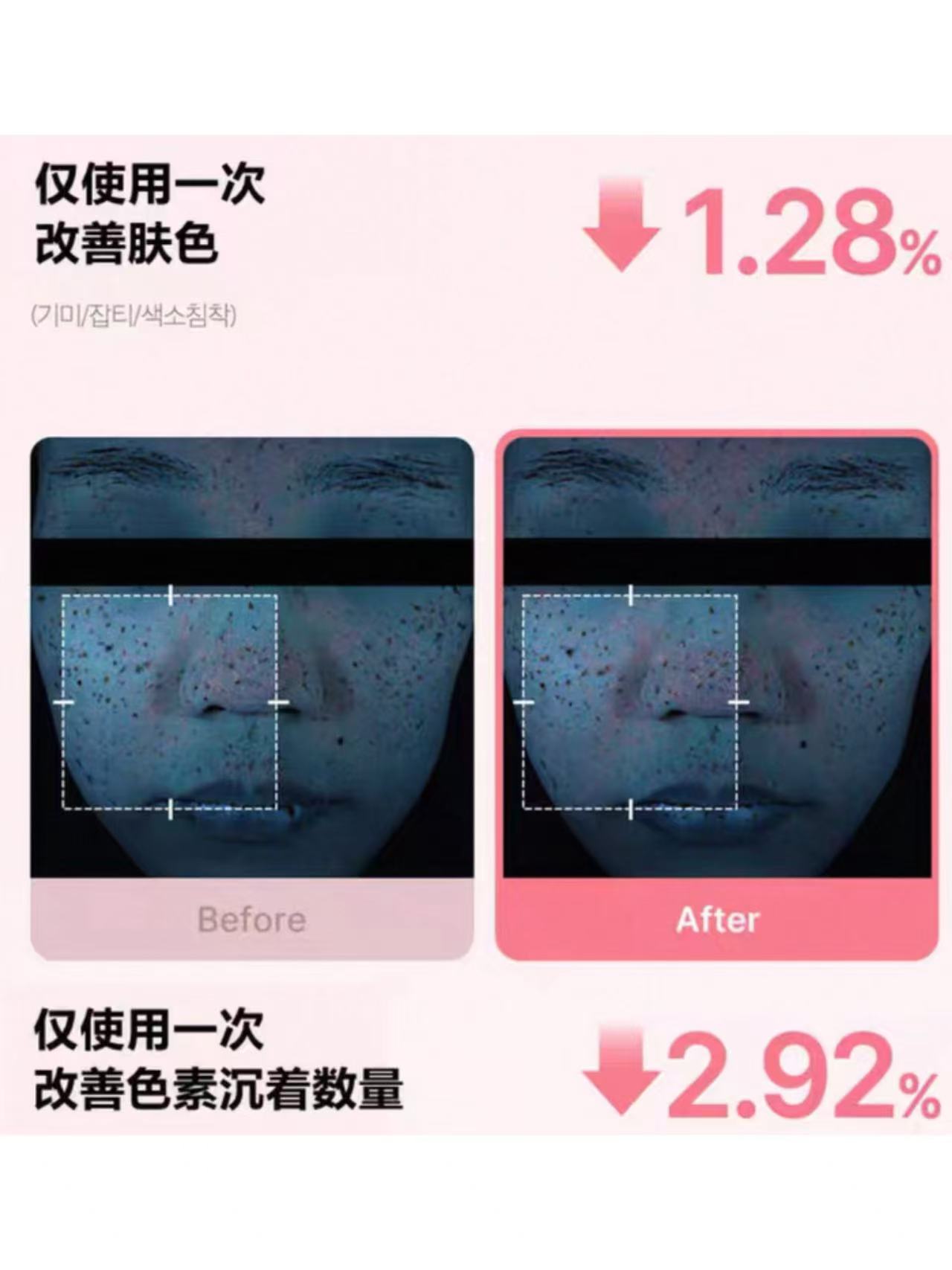 197bc134adc61c2c08fc4605036d534b