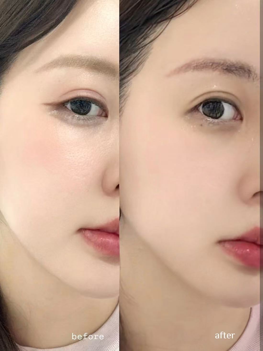 30f974c3c91f0559502fa19770b92635