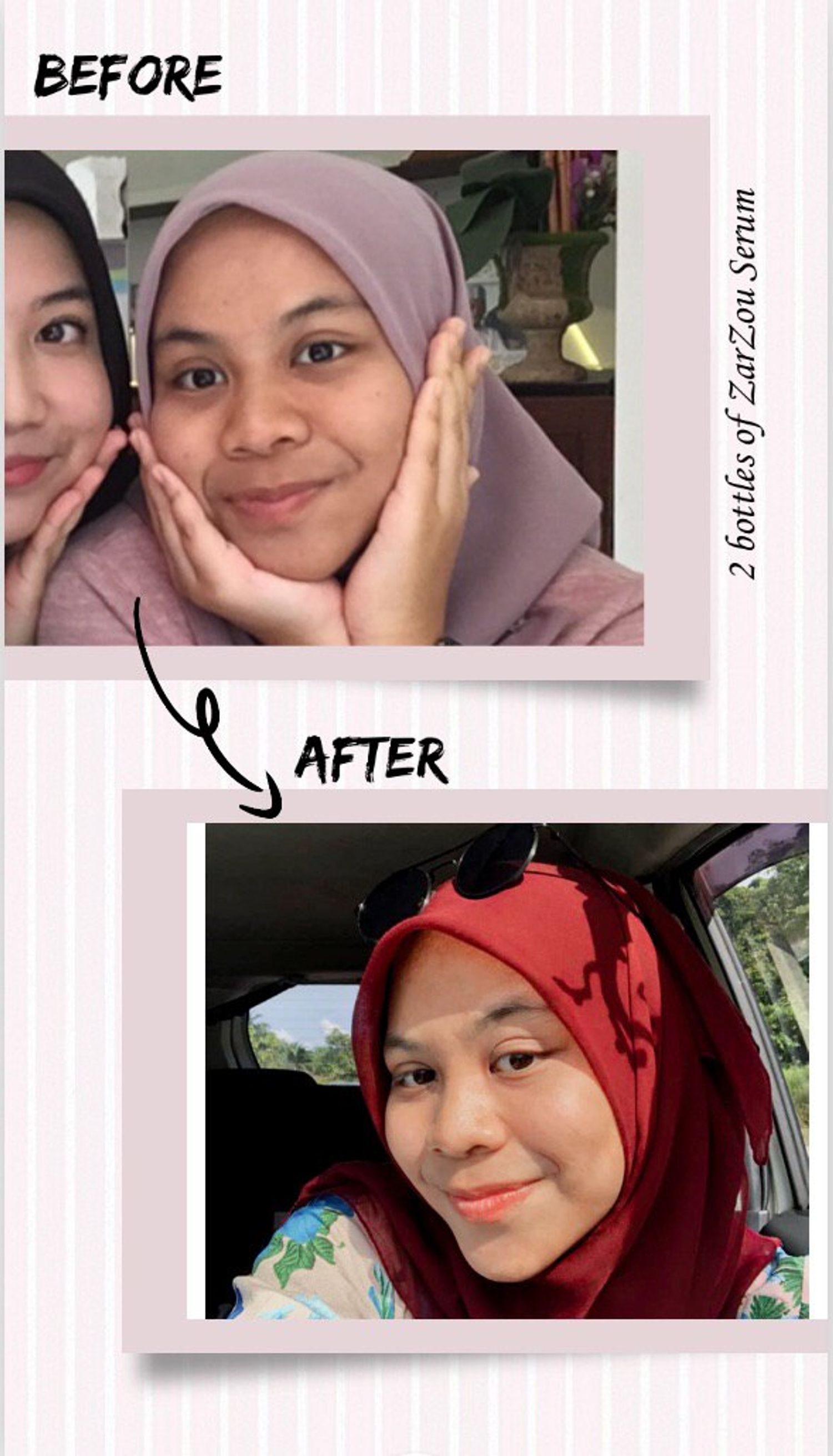 Skin Fairyy - Zarzou serum testimonial