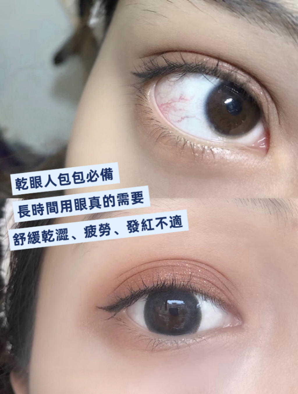 德國 Doppelherz 02％玻尿酸滴眼液 10ml-2