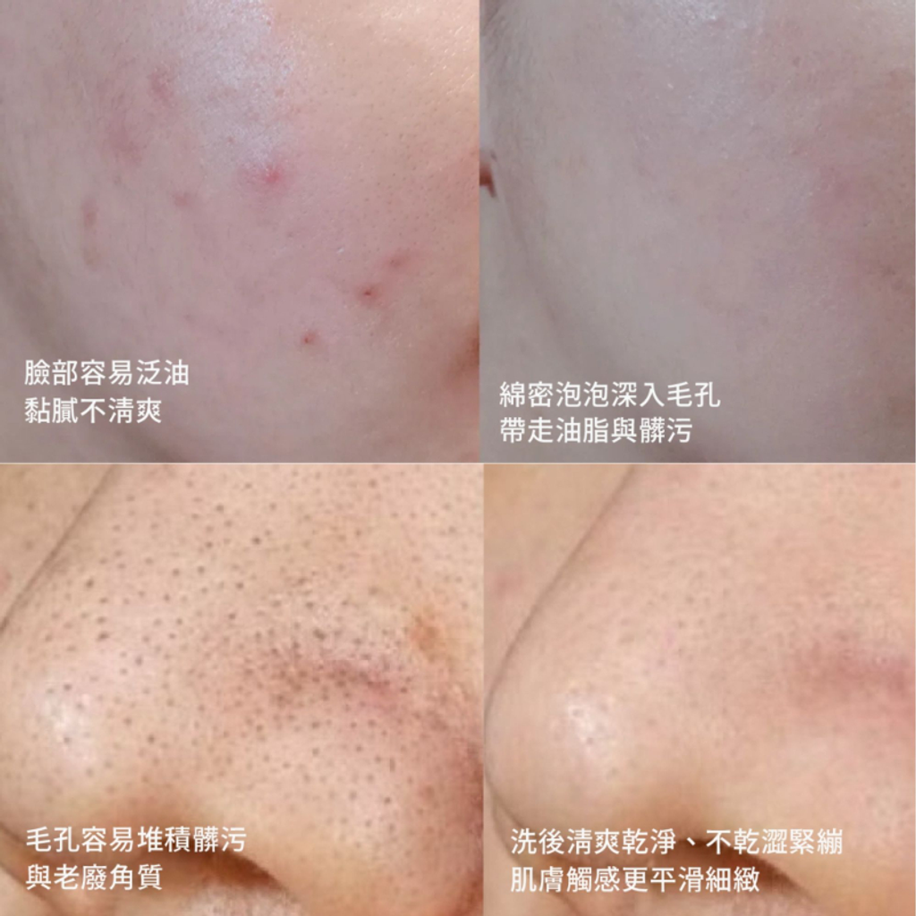 韓國OBgE 控油多合一洗卸慕斯200mL-8