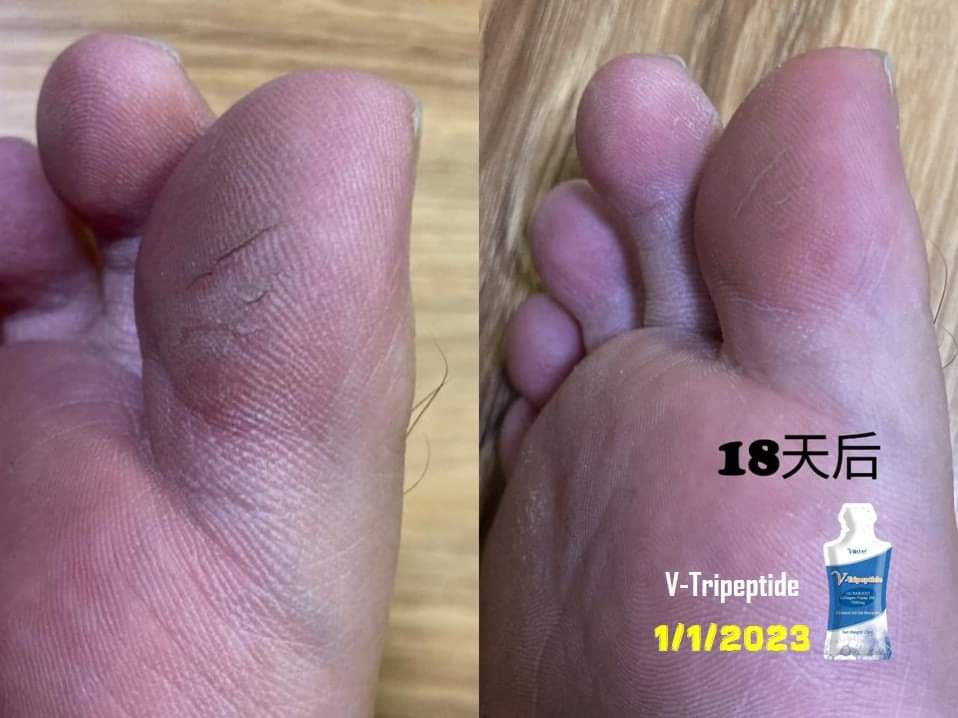 51