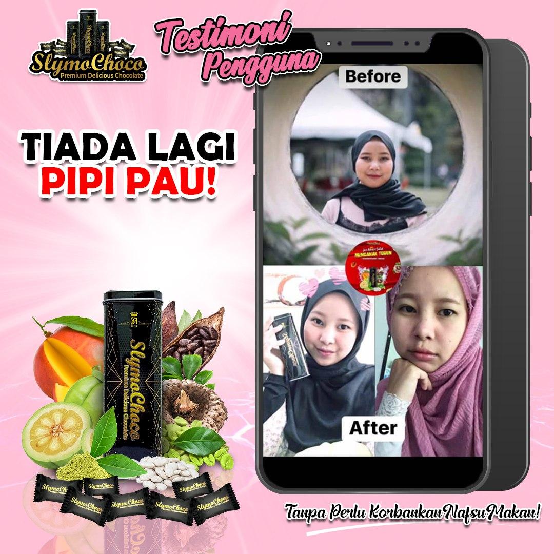 14 (nurse tercengan).jpg