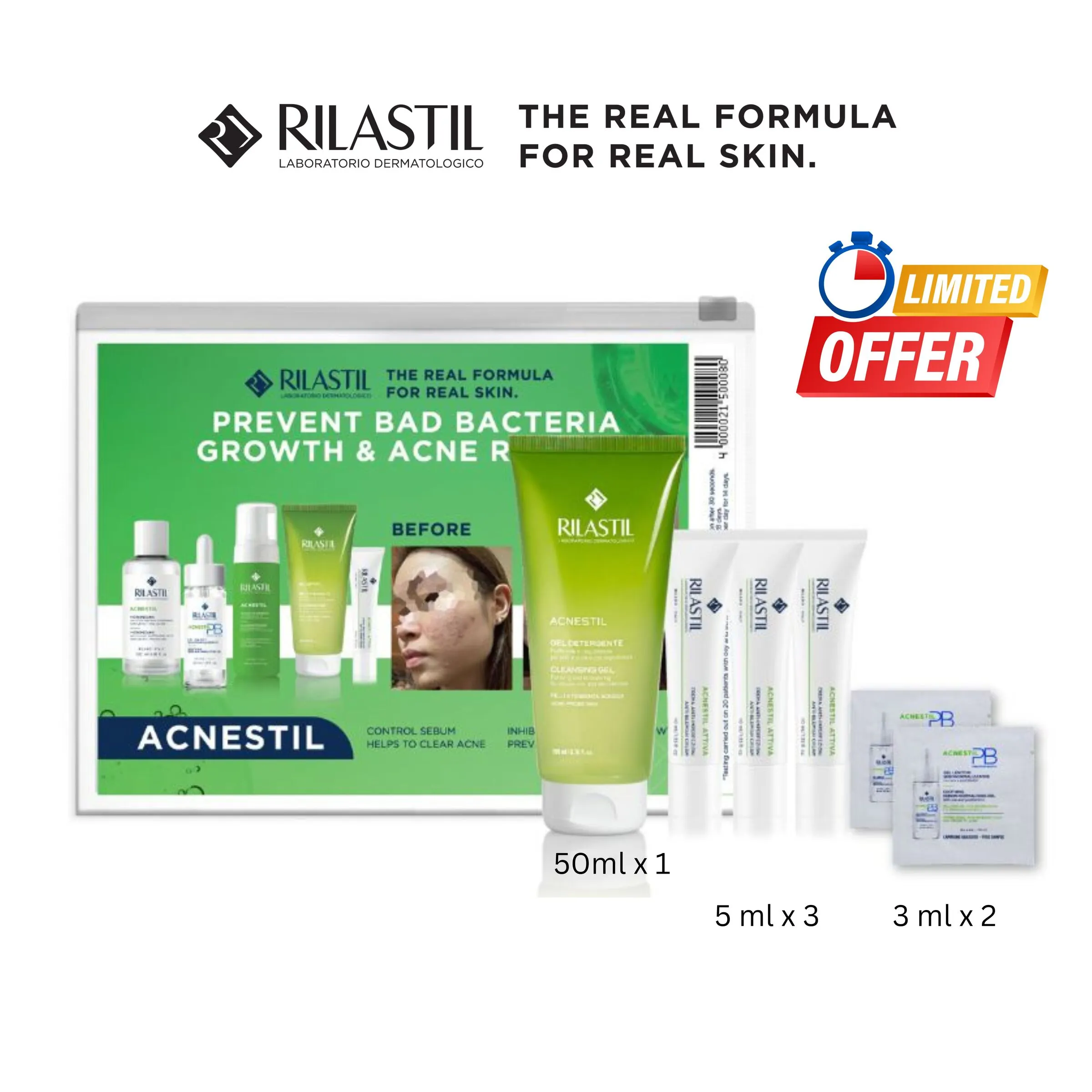 rILASTIL ACNESTIL TRAVEL SET (1)