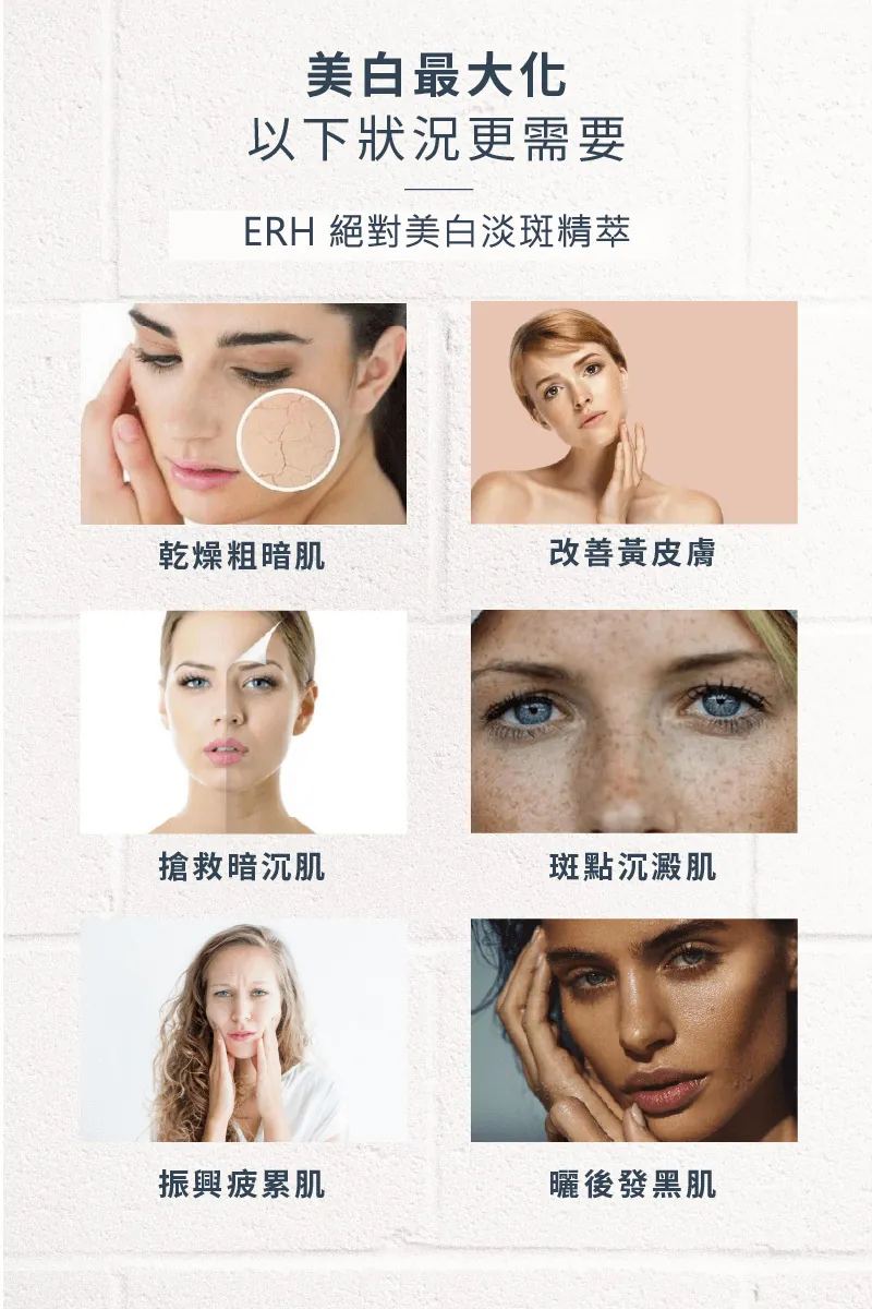 SE010_Brightening new_4