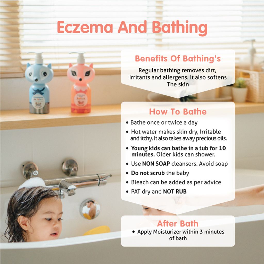 ECZEMA-AND-BATHING